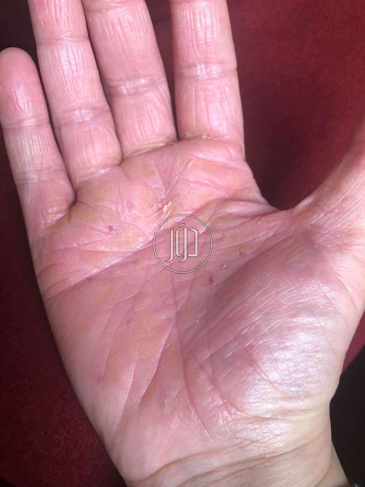 صور مستحضرات طبية للبيع في الكويت - دوّر.كوم