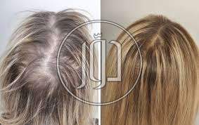 صور خدمات اخرى في الإسكندرية - دوّر.كوم